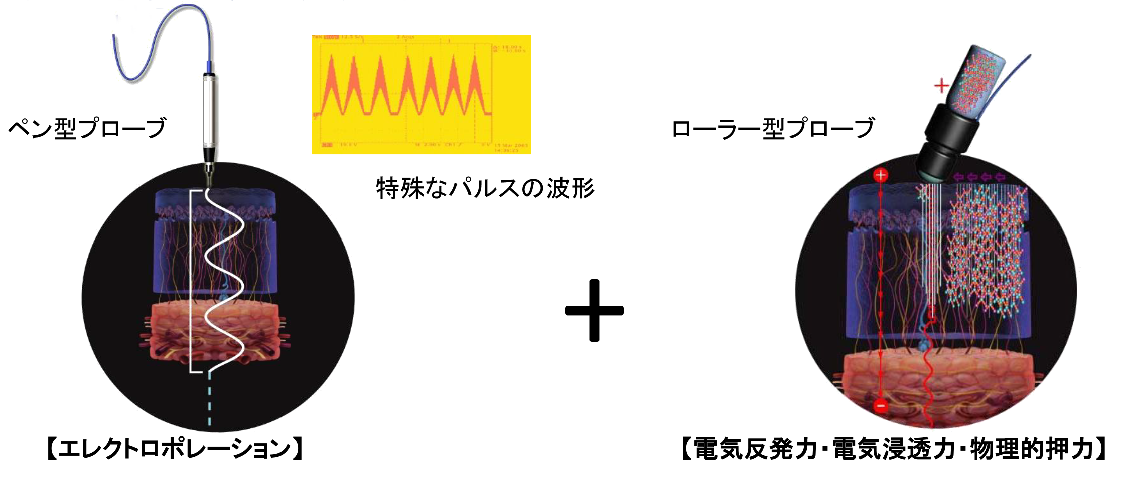 メソポレーション法の施術内容